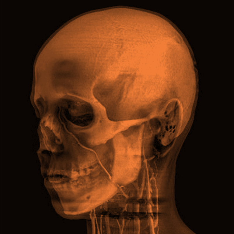 Portfolio Hover Featured Image